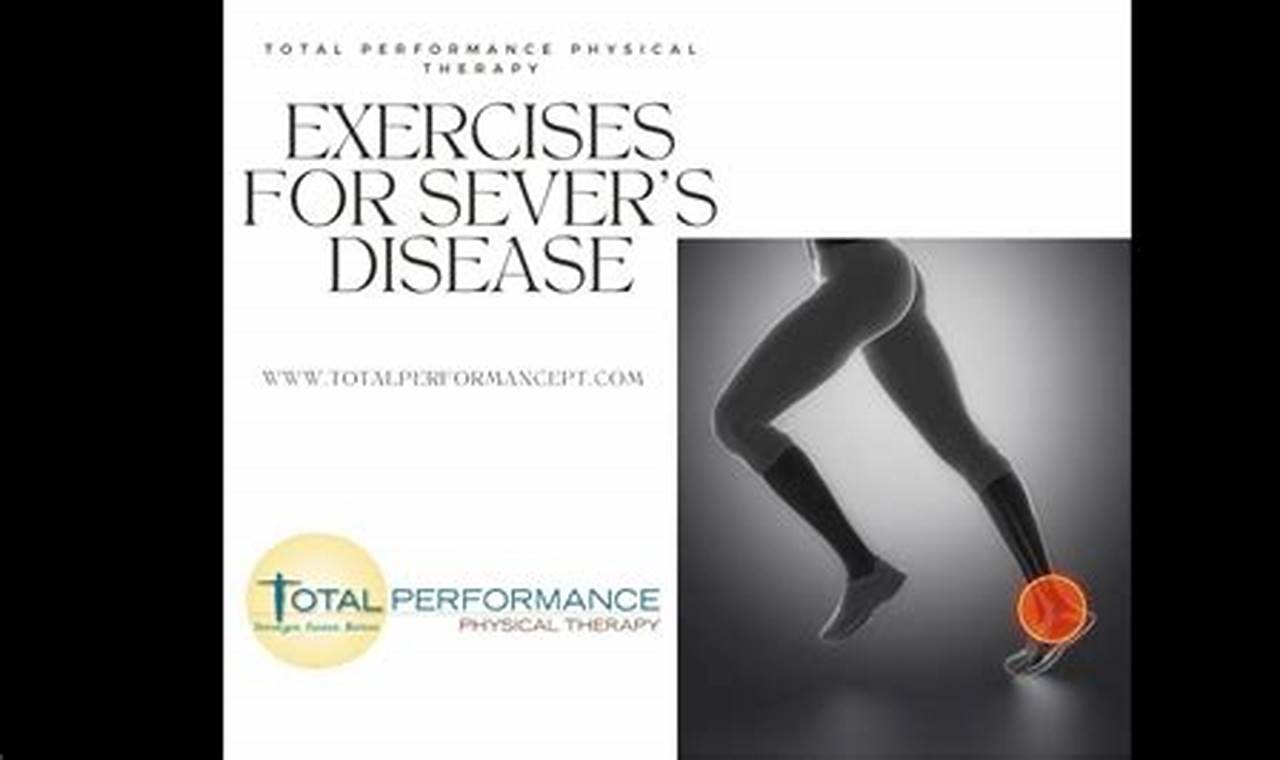 Sever's Disease Physical Therapy Exercises