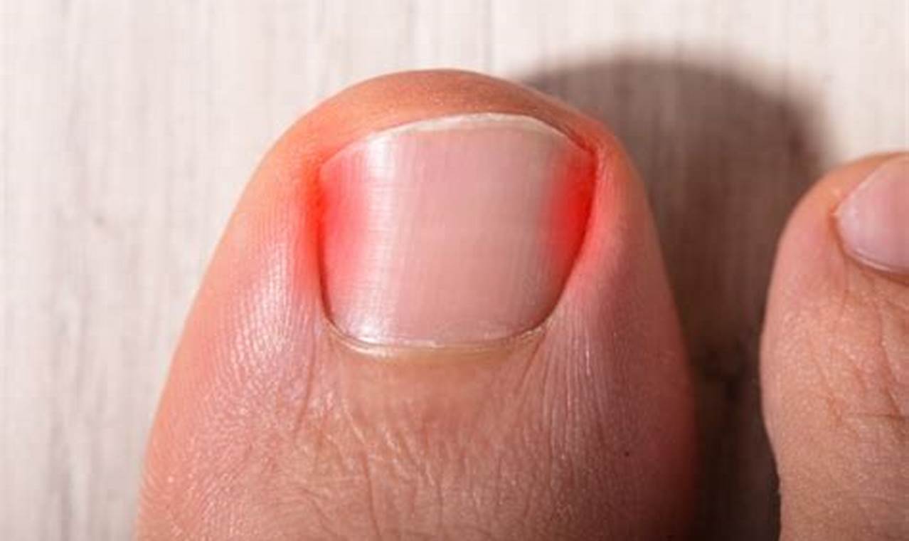 Should I Get a Pedicure With an Ingrown Toenail?