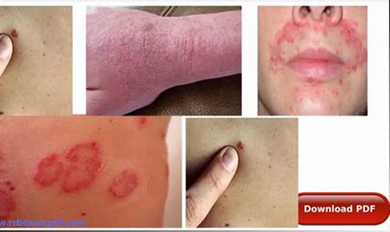 Your Visual Guide: Skin Diseases List with Pictures PDF for Expert Diagnosis