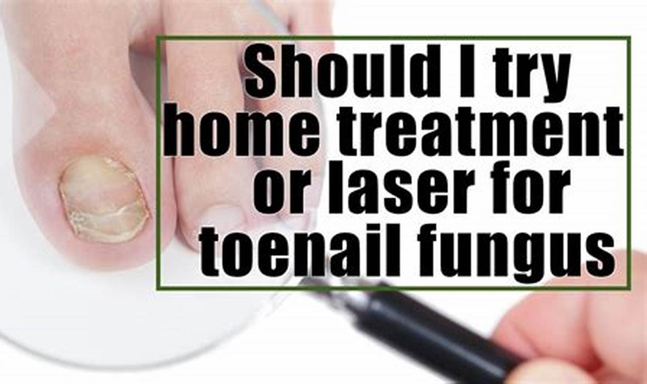 Toenail Fungus Laser Treatment at Home
