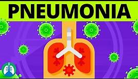 Pneumonia Overview | Causes, Symptoms, Diagnosis, and Treatment