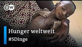 Steigende Hungersnot: Diese Länder sind am schwersten betroffen | 5 Dinge