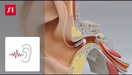 Hearing loss | Signia Hearing Aids