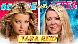 Tara Reid | Before & After | Transformation After Multiple Surgeries?