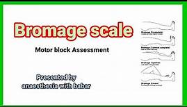Bromage scale | motor block Assessment @anaesthesiawithbabar2576 #short