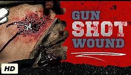 Gunshot Wound: Everything You Need To Know