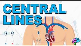 The Basics of Central Lines - Central Venous Catheters (CVC)