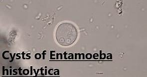 Cysts of Entamoeba histolytica | Saline wet mount | @labmedicine9265