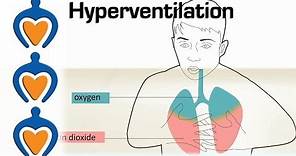 Hyperventilation - Causes and treatment of hyperventilation