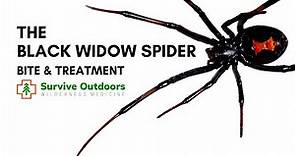 Black Widow Spider Bite and Treatment Latrodectus