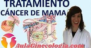CÁNCER DE MAMA: ESTADIAJE Y TRATAMIENTO: CIRUGÍA, QUIMIO-RADIO TERAPIA...- Ginecología y Obstetricia