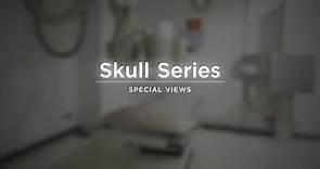 Skull Special Views - Radiography Positioning