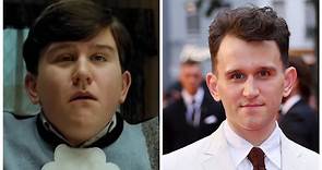 The Queen’s Gambit star Harry Melling says weight loss means people no longer recognise him from Harry Potter