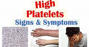High Platelets (Thrombocytosis) Signs & Symptoms | Rapid Review