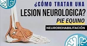 🧠ESPECIALISTAS en REHABILITACIÓN NEUROLÓGICA 🦶 Pie Equino / Lesión Cerebral
