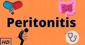 Peritonitis, Causes, Signs and Symptoms, Diagnosis and Treatment.