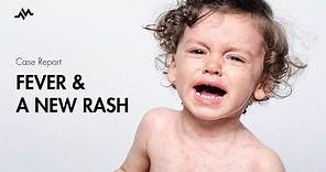 Pediatric Fever and Rash - Case Report