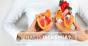What Is Ischemia? | Dr. John Osborne | Top10MD