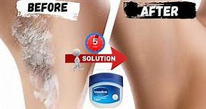 In Just 5 Minutes, Remove Unwanted Hair Permanently, NO SHAVE NO WAX | Painless Hair Remover
