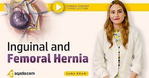 Inguinal and Femoral Hernia (Trailer) | General Surgery | Online Video Education | V-Learning