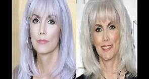 emmylou harris plastic surgery