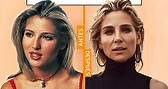 Antes y después Elsa Pataki