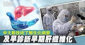 【醫療科技】中大學者研無創生化成像技術　檢測早期肝纖維化 - 香港經濟日報 - 即時新聞頻道 - 科技