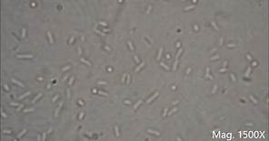 Bacteria under the Microscope (E. coli and S. aureus)