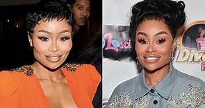 Blac Chyna Makes First Public Appearance Since Dissolving Facial Fillers: See the Transformation