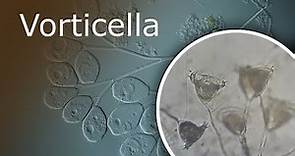 All About Vorticella: Description, History and Habitat. Vorticella Under a Microscope (100x-1000x)