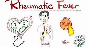 Rheumatic Fever - Jones Criteria - Causes, Signs, Symptoms, Diagnosis & Treatment - Cardiology
