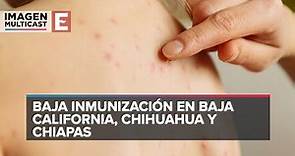 México en riesgo de sufrir brote de sarampión por rezago en vacunación