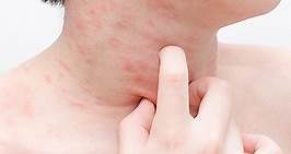 Skin Rashes In Children: Causes And Treatment