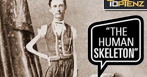 P. T. Barnum’s 10 Most Famous Human “Freak” Show Attractions