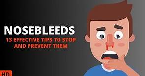 Nosebleed 101: What You Need to Know