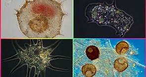 Ciclo de Vida de las Amebas ¿Qué Tipo de Reproducción Tienen las Amebas?