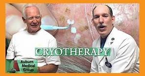 Actinic Keratosis Frozen with Cryotherapy | Auburn Medical Group
