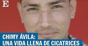Chimy Ávila, ante la final de Copa del Rey: Una vida llena de cicatrices | EL PAÍS