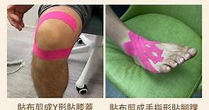運動貼布短片示範｜物理治療師示範兩貼法　助改善關節活動不順暢下肢腫脹　皮膚敏感不宜使用 (10:42) - 20221103 - 熱點