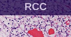 Renal Cell Carcinoma - Pathology mini tutorial