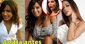 Anitta antes y después de sus cirugías.😱