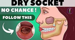 Tooth extraction aftercare I Wisdom tooth extraction - Tips for faster healing & prevent dry socket