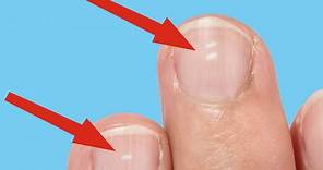 Here's what those white marks on your nails say about your health
