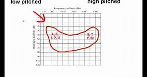 How to Read an Audiogram - Watch this Video Before You Buy Hearing Aids!