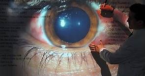 Traumatismos Oculares - Tipos y Tratamiento - Patología Ocular