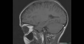 MRI Brain Anatomy LECTURE