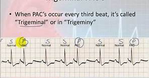 Basic Electrophysiology, part 7 - Atrial Rhythms, part 1, Introduction and PAC's