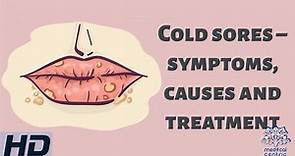 Cold Sores – Symptoms, Causes and Treatment