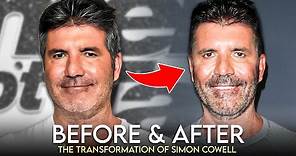 Simon Cowell | Before & After | What Happened To His Face?