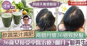 【脫髮治療】飲蔬菜汁減肥兩個月瘦36磅致脫髮　36歲港女接受中醫治療3個月恢復髮量【附食療】 - 香港經濟日報 - TOPick - 健康 - 醫生診症室